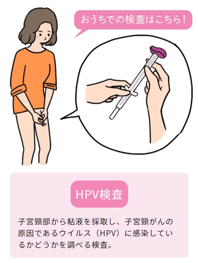 HPV検査